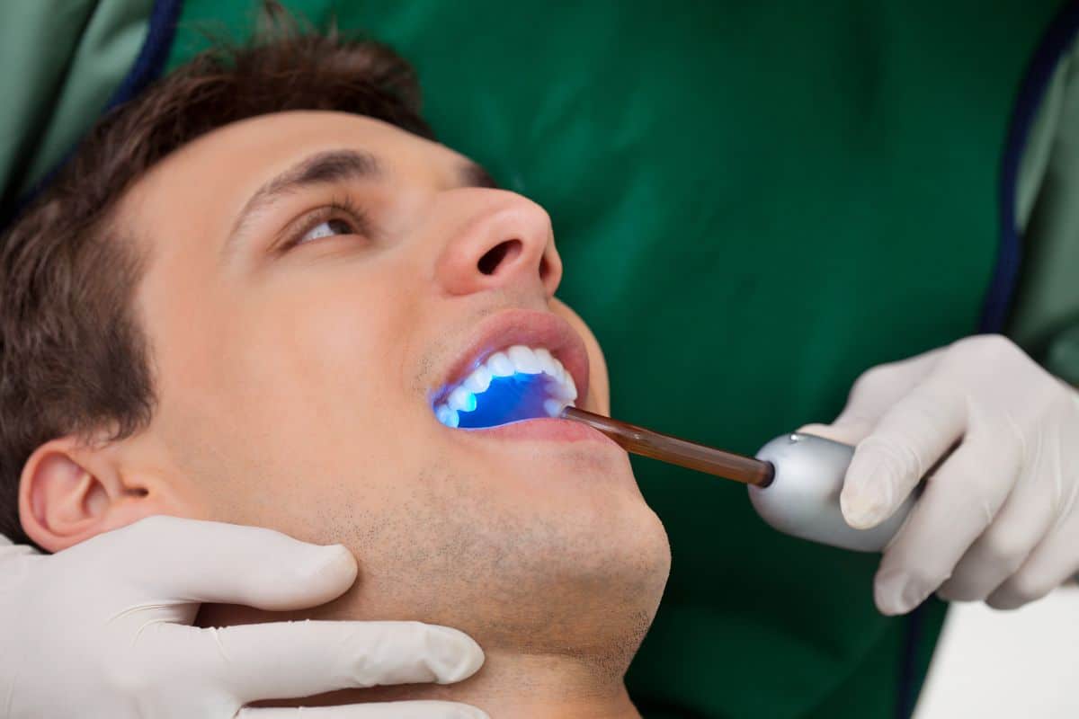Dentist applying blue dental sealant to patient's tooth during treatment procedure.