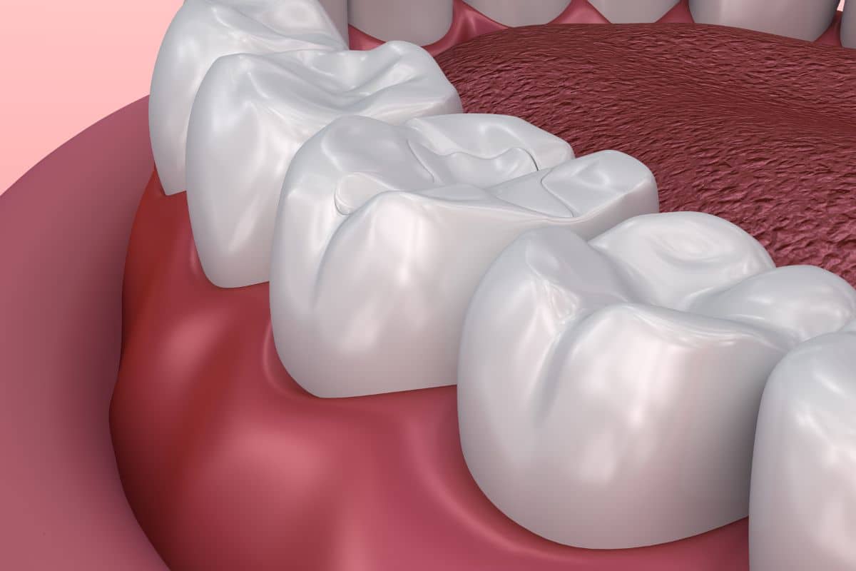 Dentist Sandy UT