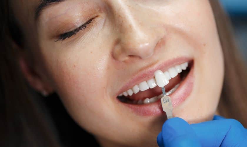 Ultimate Guide To Veneers For A Perfect Set Of Teeth