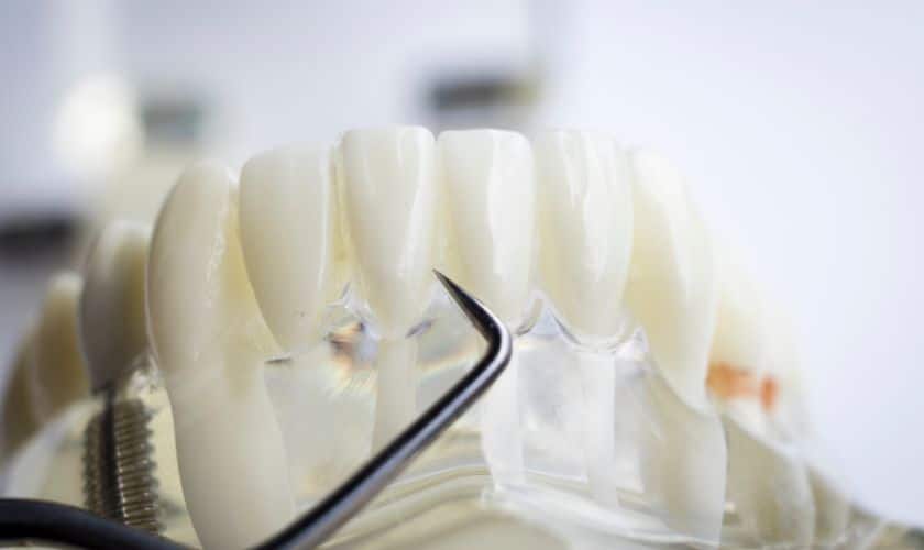 cosmetic dentist in Sandy Revamp Your Smile With A Top Cosmetic Dentist In Sandy