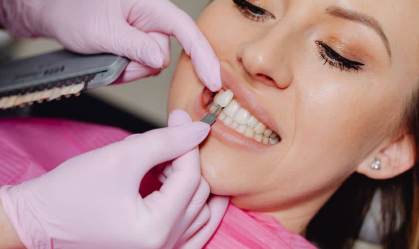 Veneers Care Tips For Maintaining Long-Lasting Results