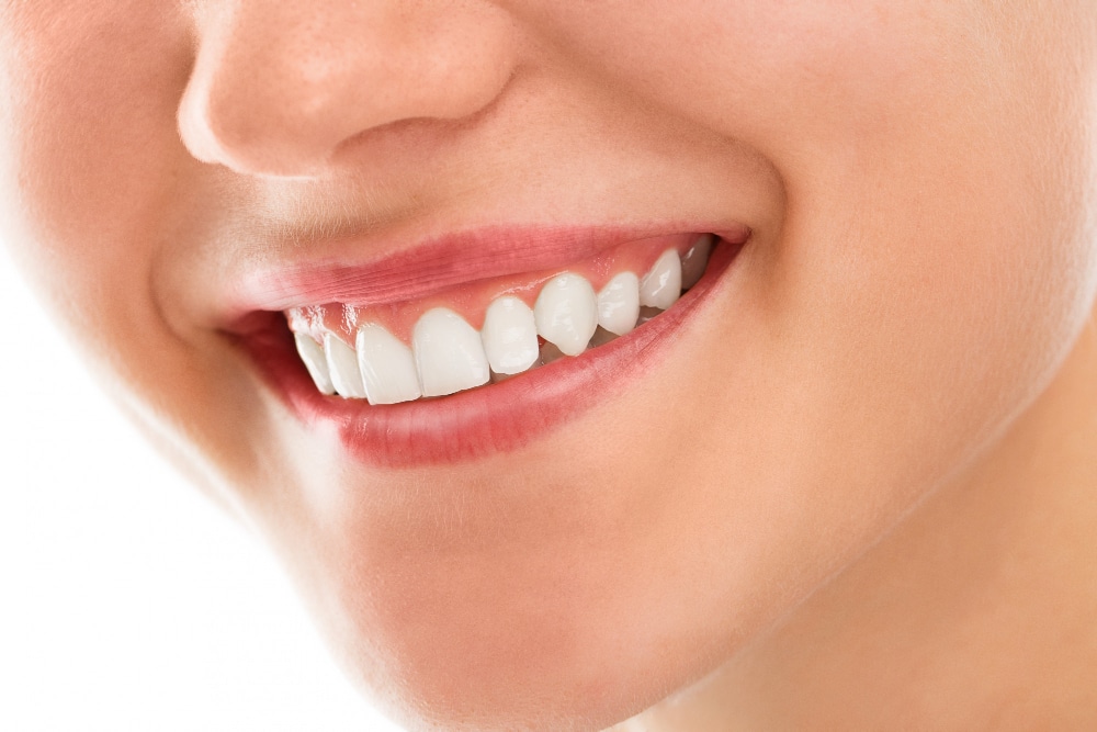5 Reasons Why You Should Whiten Your Teeth Today