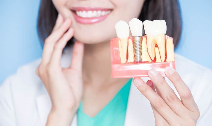 Top 5 Frequently Asked Questions About Dental Implants