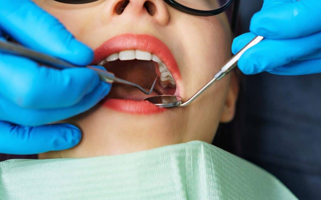 Essential Tips for Maintaining Routine Dental Care During the Holiday Season