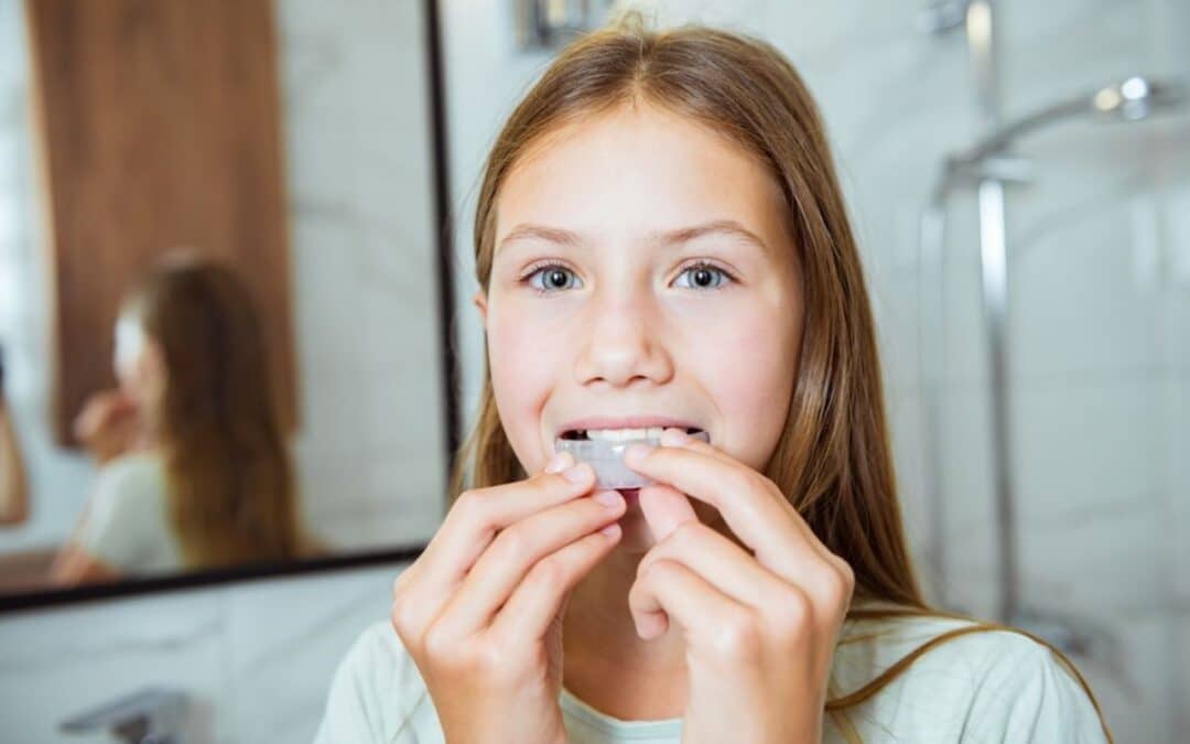 What Happens If You Don’t Wear a Night Guard for Teeth Grinding?