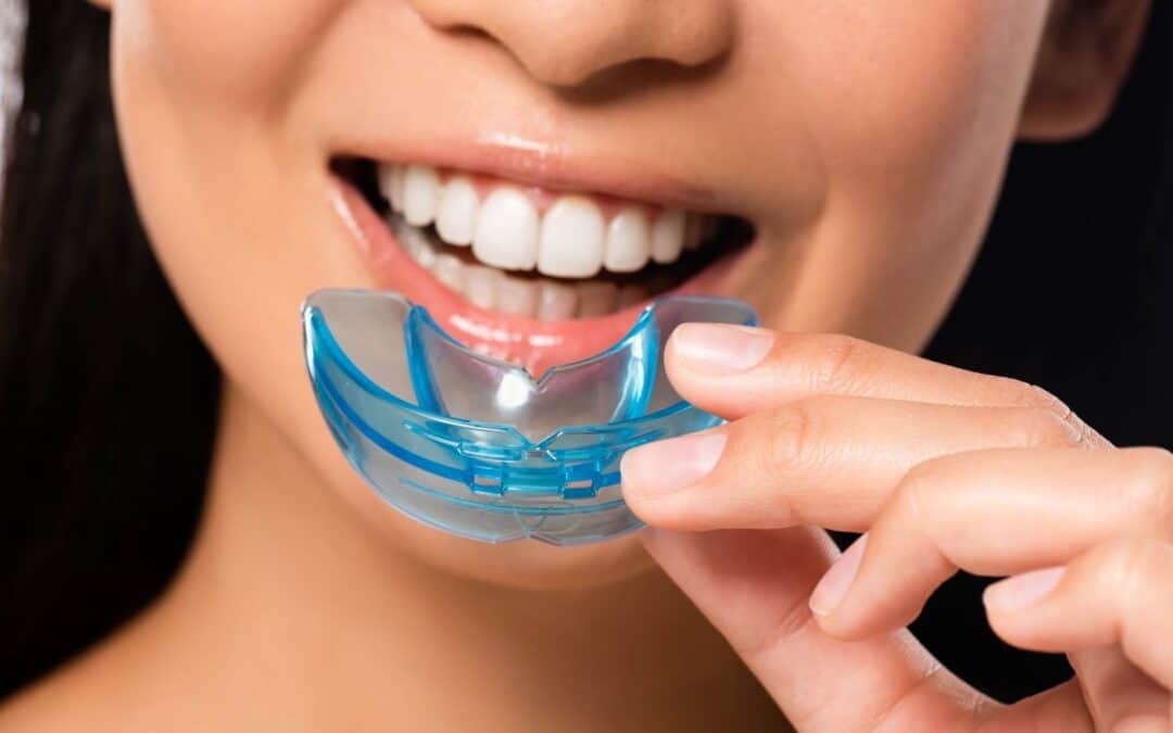 Are Over-the-Counter Night Guards Safe? What Dentists Want You to Know