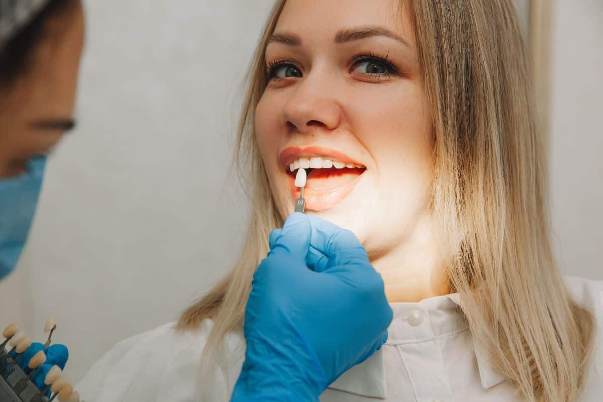 Can You Get Cavities Under Veneers (1) cosmetic dentistry sandy