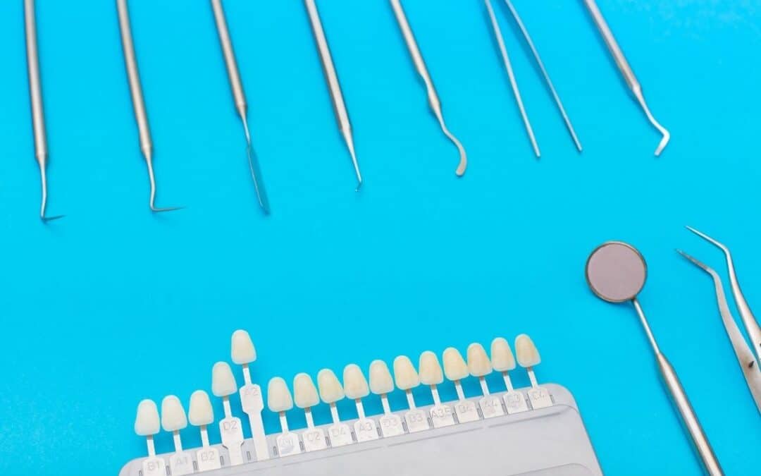 Do Teeth Rot Under Veneers? Myths and Facts Explained