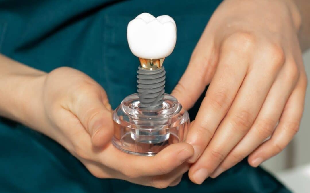 Why Dentists Try to Save Teeth Instead of Pulling Them