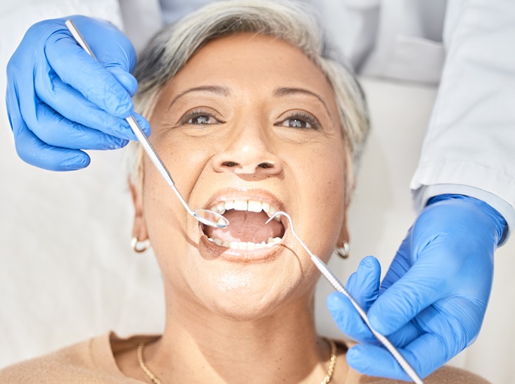 Choose a Dentist in Alexandria for Personalized Care