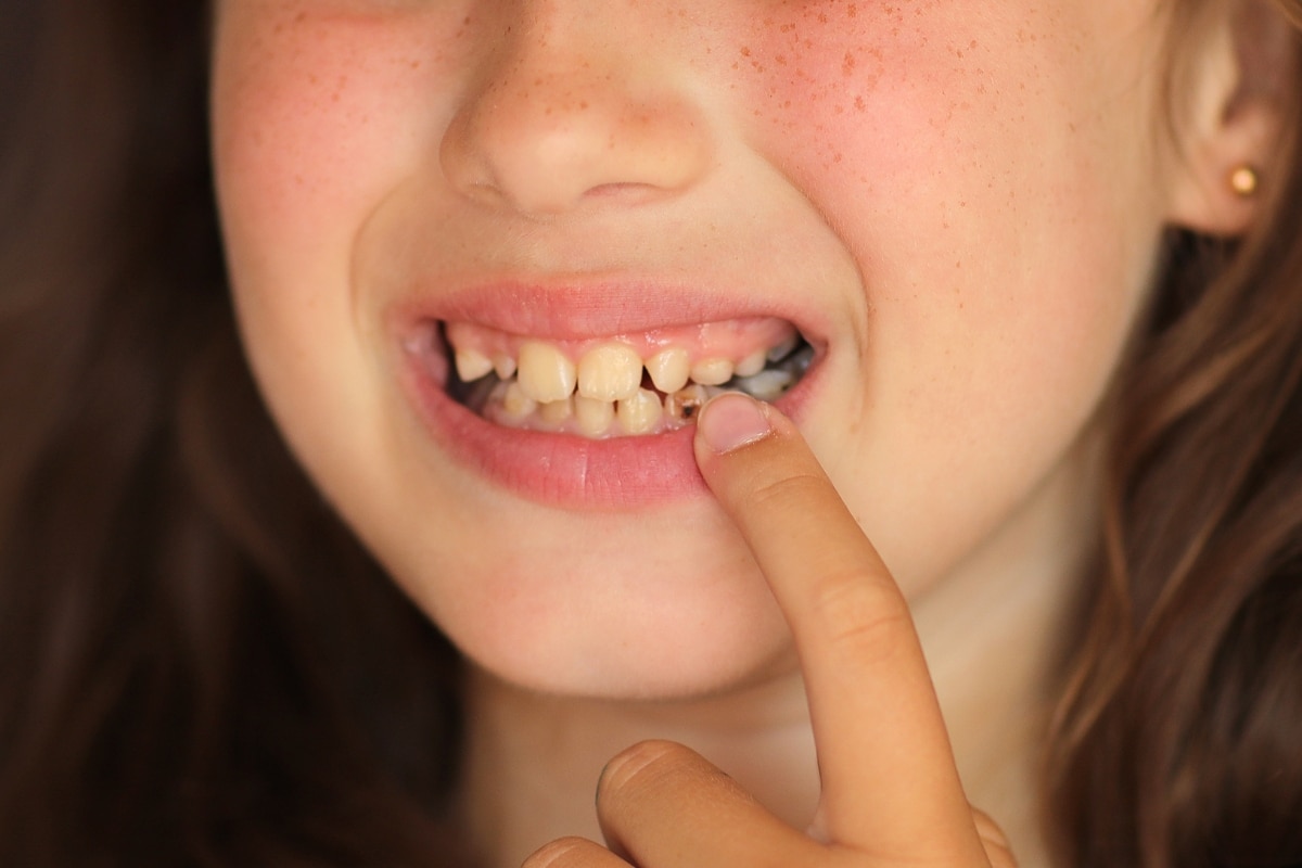 Pediatric Dentist Upland