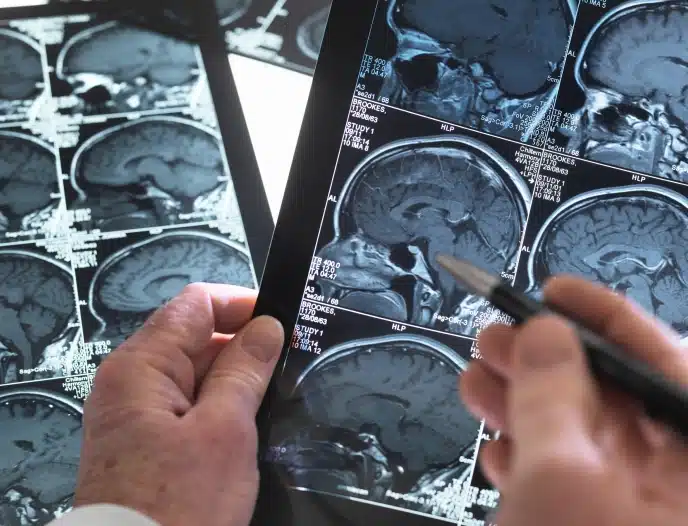 Traumatic Brain Injuries