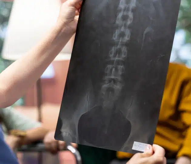 spinal-cord-injury