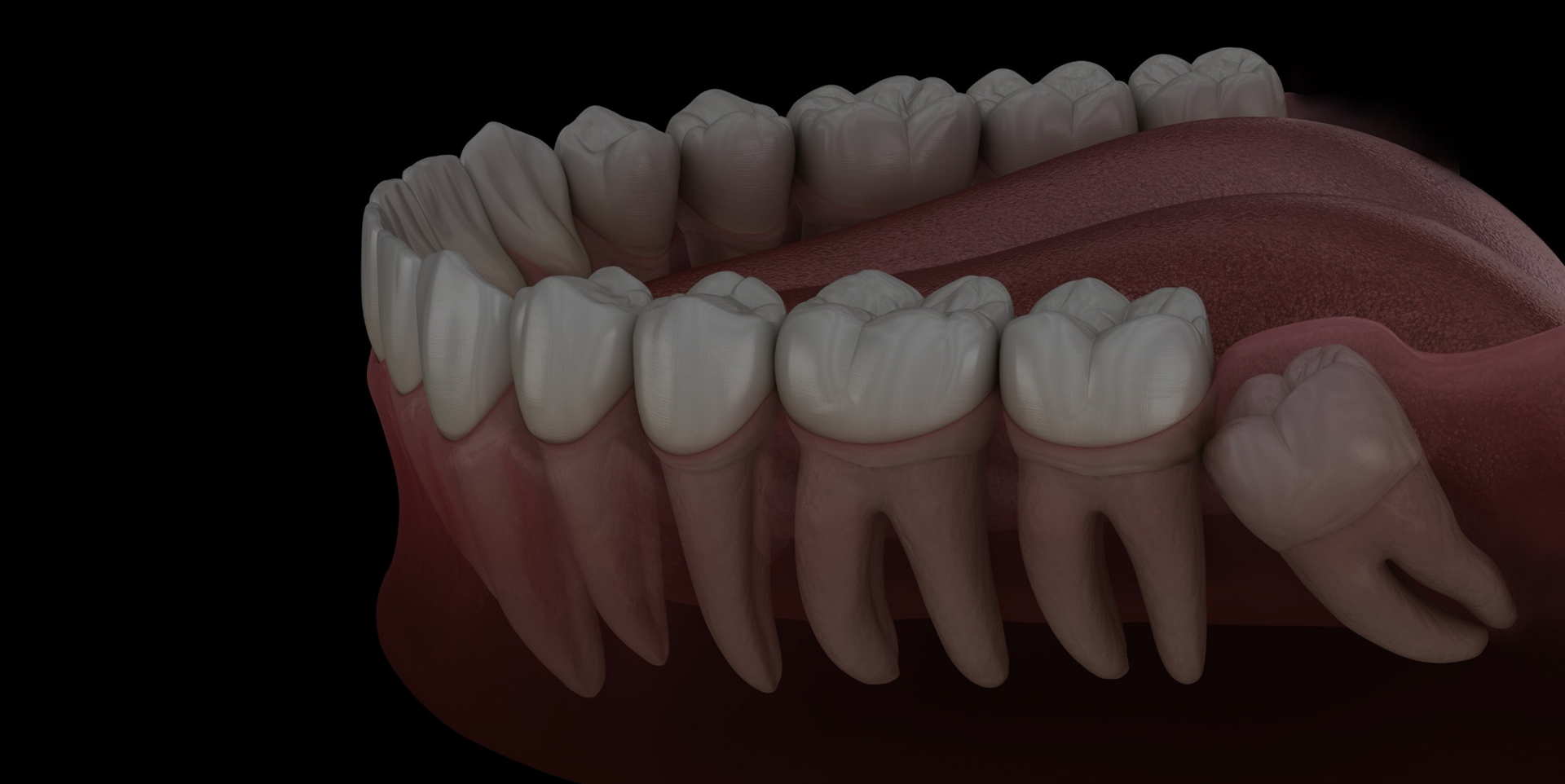 Remove damaged tooth at at Coastal Dental Arts in Peabody, MA