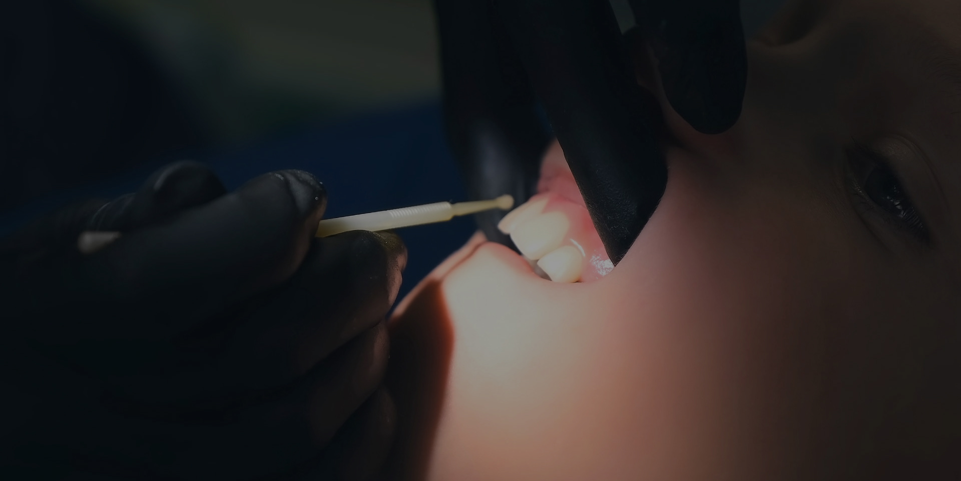 Dentist providing fluoride treatment to a patient at Coastal Dental Arts in Peabody, MA
