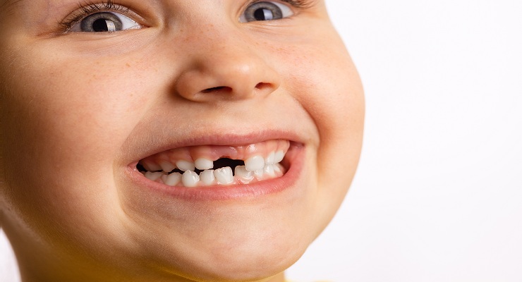 Handle a Loose Baby Tooth