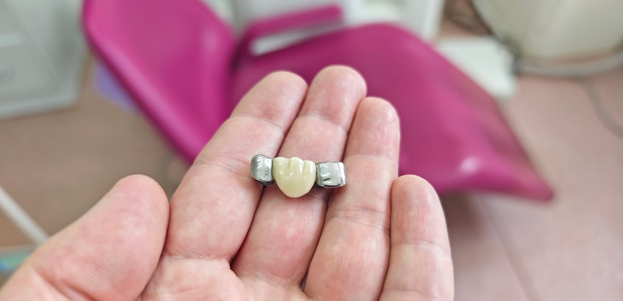 pros and cons of porcelain crowns