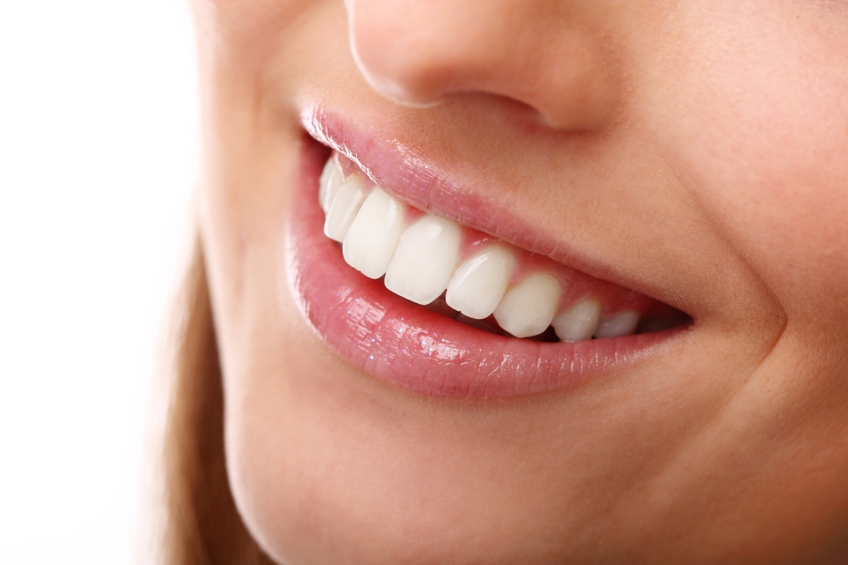 teeth-whitening-in-Chatsworth