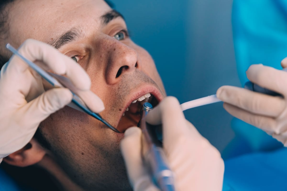 Root Canal Treatment in Chatsworth