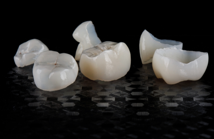 Benefits Of Dental Crowns: Why You Should Consider Them?