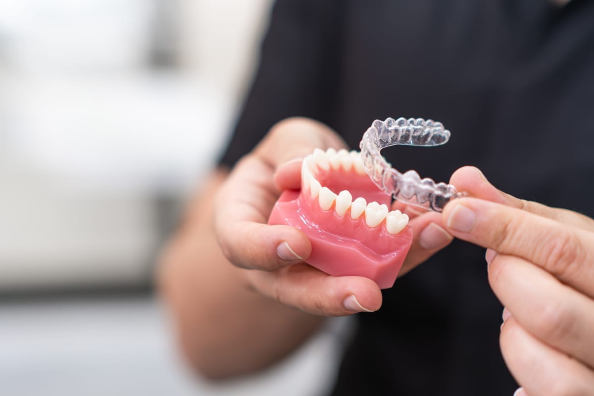 Invisalign in San Jose