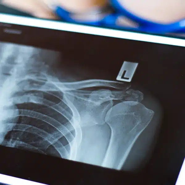 img-service-RADIOLOGÍA
