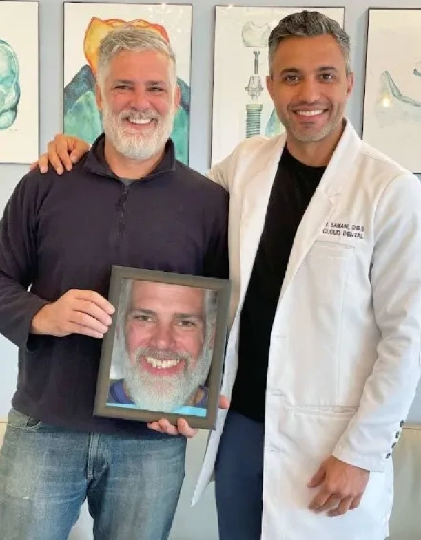 full mouth dental implants Dr. Samani Delivers World Class Implant Result Every Time