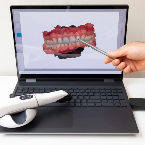 Technology Intra Oral Scanners - Cloud Dental