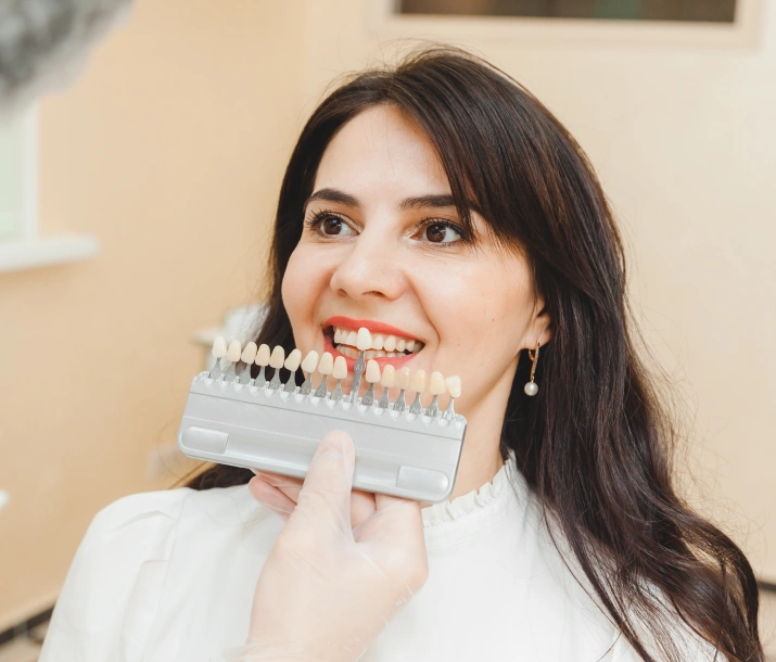 veneers Correction Dental Flaws with Veneers
