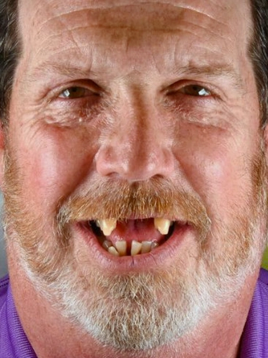Smile Transformations before