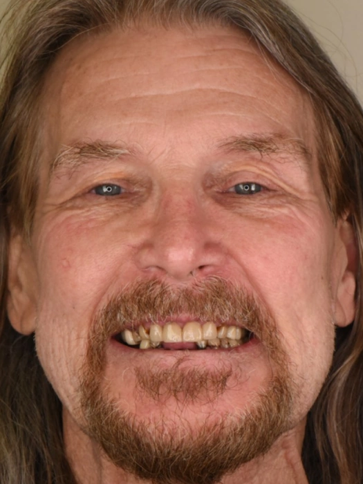 Smile Transformations before