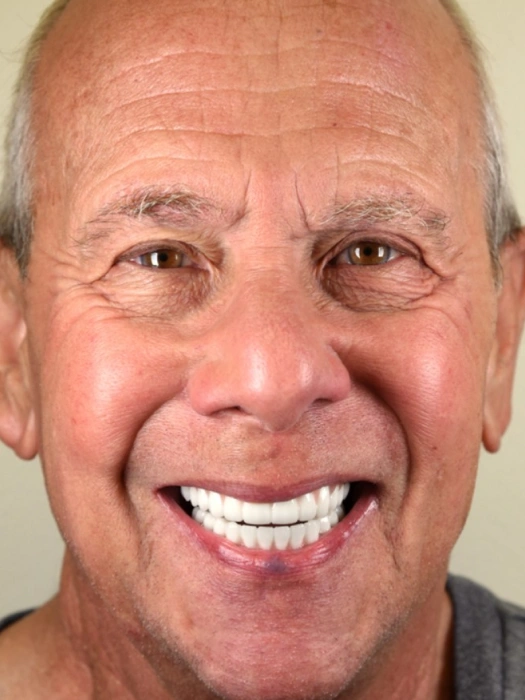 Smile Transformations before