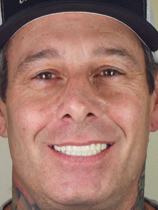 After Smile Transformations