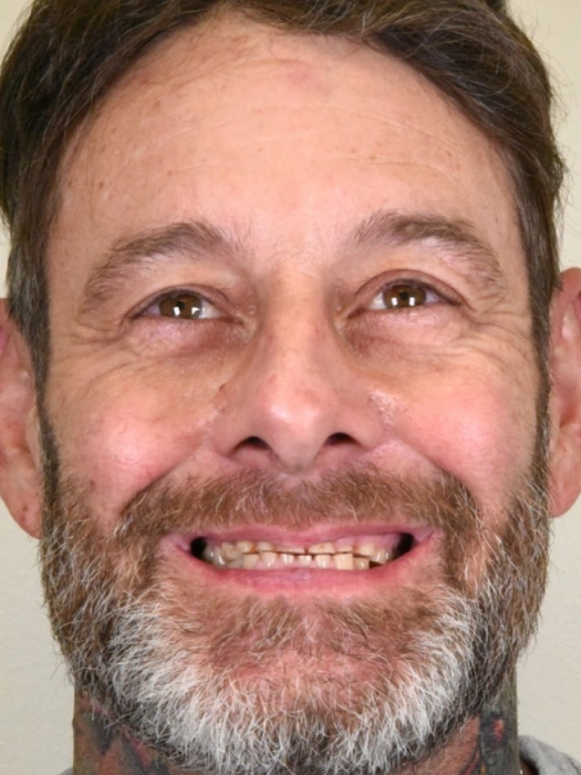 Smile Transformations before