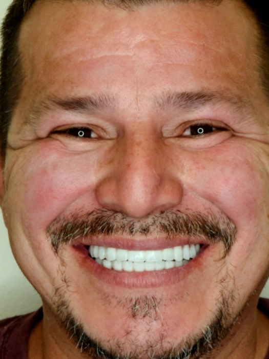 After Smile Transformations