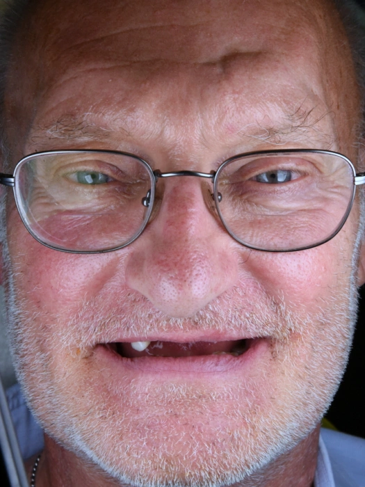 Smile Transformations before