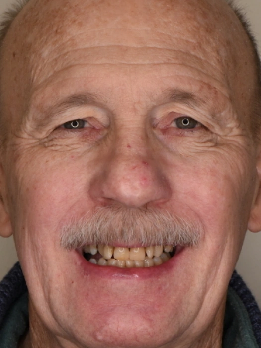 Smile Transformations before