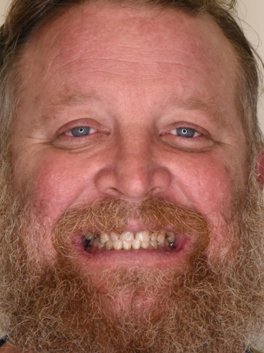 Smile Transformations before