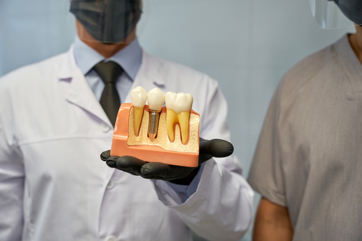 Dental Implants Austin