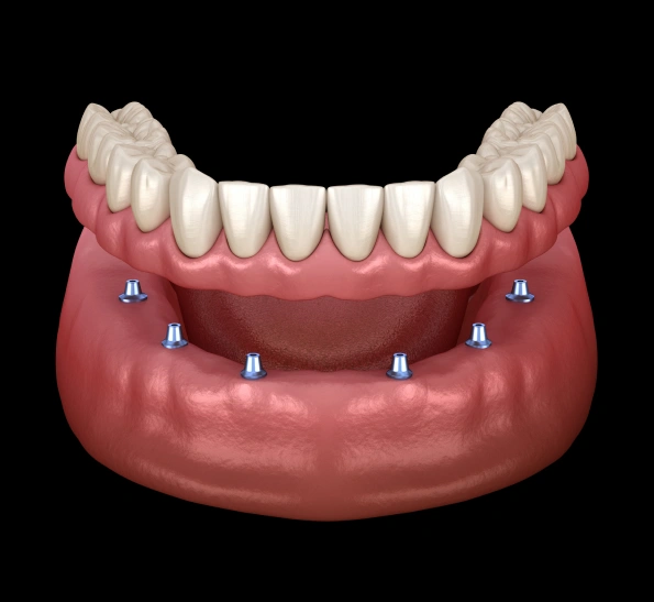Dentures For You