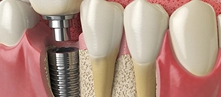Preventive Care in South Jordan