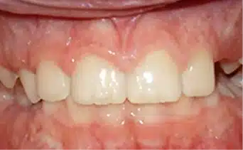 After Image 1