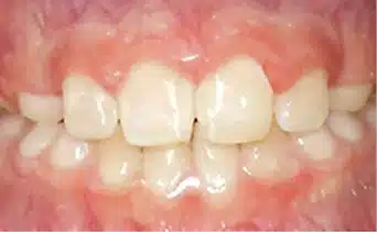 After Image 2
