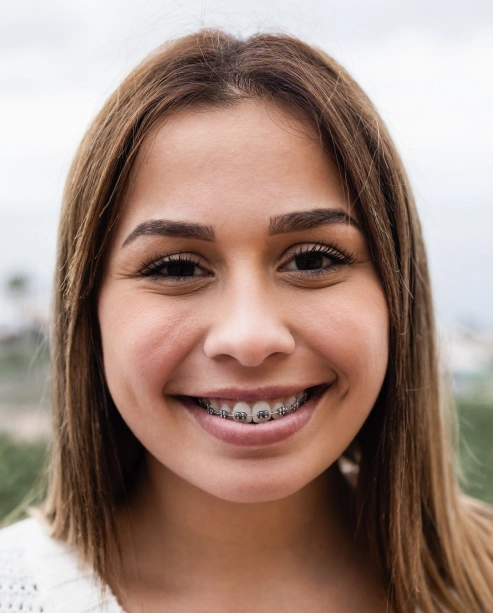 Portrait of a smiling teenage patient showing orthodontic treatment results