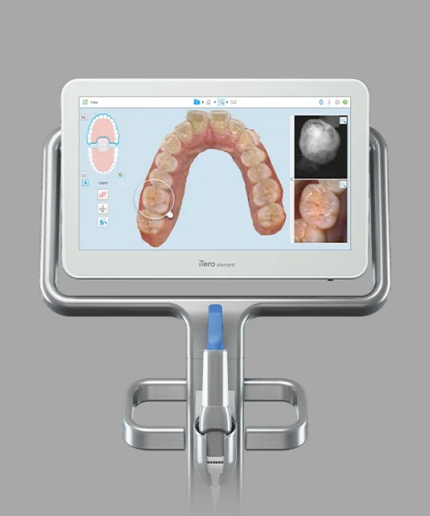 3D orthodontic imaging system displaying a digital dental model