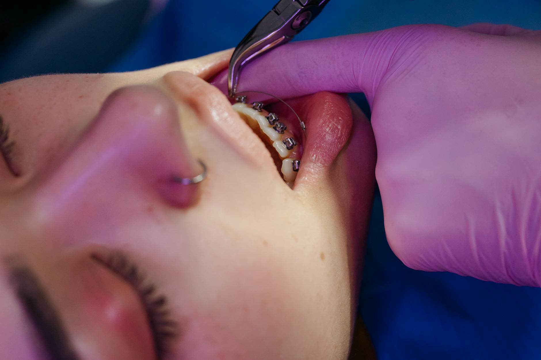 Orthodontics Cranston RI | Cranston Orthodontics