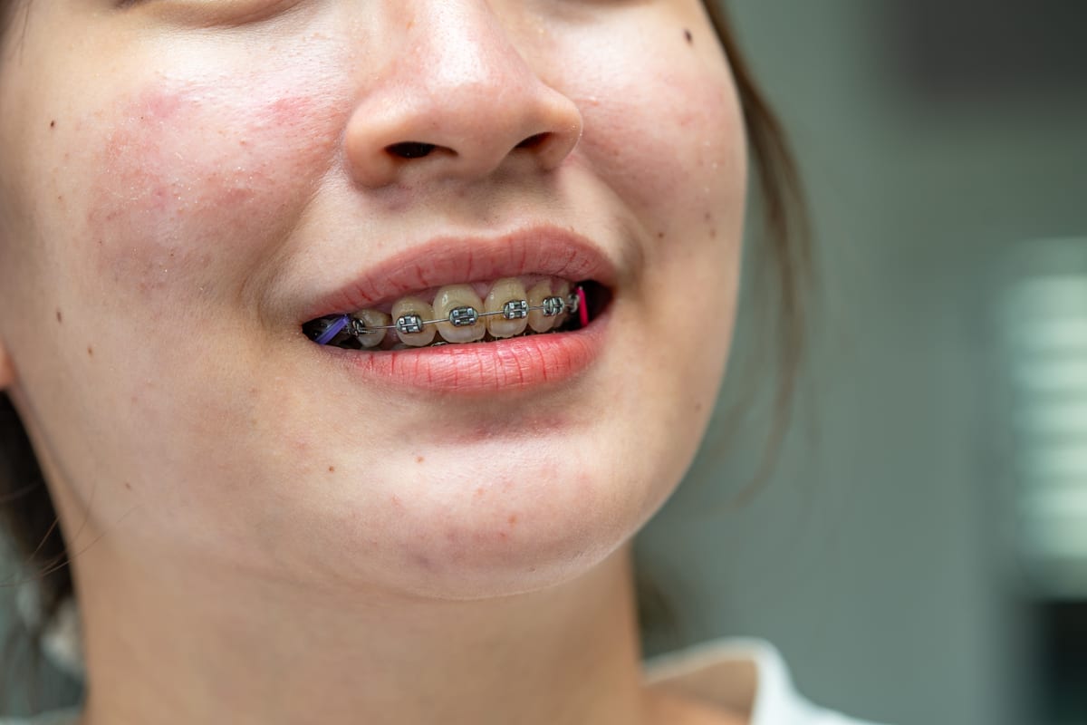Orthodontics in Cranston