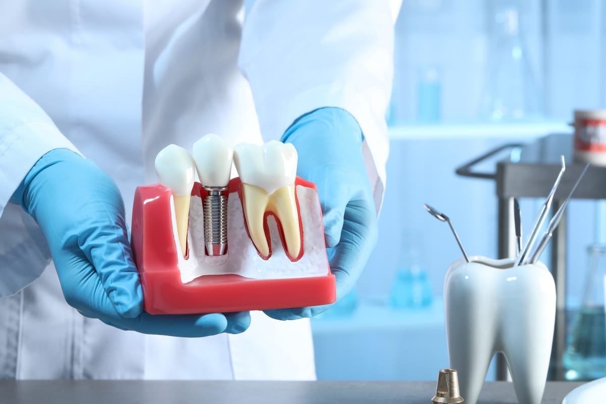 Dental Implants in McKinney
