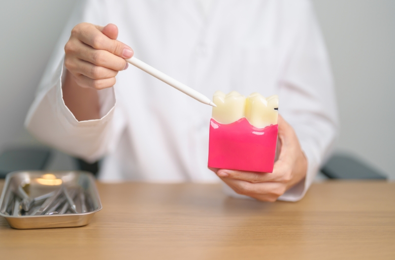 Dental Filling Treatment for Cavities in Austin TX