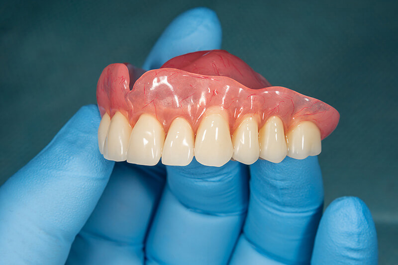 Implant supported dentures in South Austin TX held with gloved hands for tooth replacement treatment